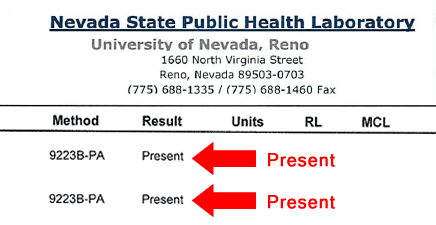 laboratory result